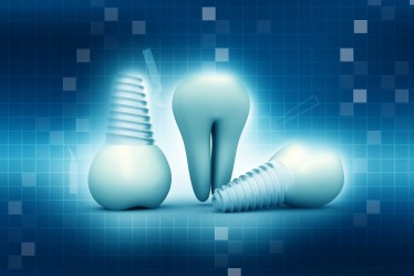 Tooth human implant on abstract background